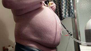 Stomach Inflation with Nearly two Gallons of Water