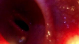 POINT OF VIEW: Jamming you in and pulling you deeper